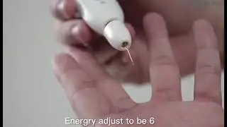 Original Korea FDA Approved Plamere Plasma Pen