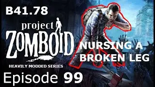 Nursing A Broken Leg | Project Zomboid Ep 99 | Build 41.78