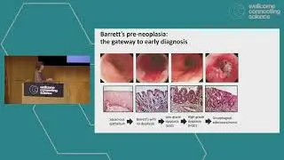Cancer Evolution 2024 | Keynote by Professor Rebecca Fitzgerald, University of Cambridge, UK