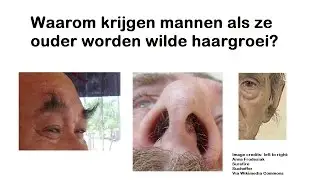 Waarom krijgen mannen als ze ouder worden wilde haargroei?