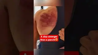 This Ancient Slap Can Bend Steel