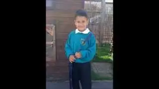 RARE CHROMOSOME DISORDER ~ Dowie living with T8M (Trisomy 8 Mosaic syndrome)