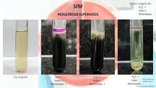 SIM - Sulfeto de hidrog&ecirc;nio Indol Motilidade