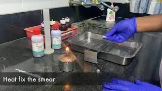 Standard ZN stain