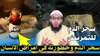 سحر الـدم وخطورتة فى امراض الانسان اقوى علاج لفك سحر الـدم