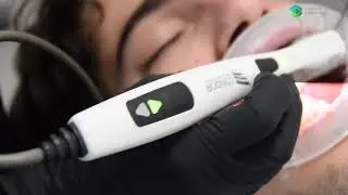 Scanner intra-oral Condor&reg;