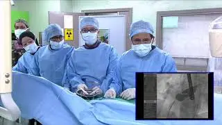 CSI Frankfurt 2019 Live Transmission: Transcatheter Closure using Cera Fenestrated ASD Device