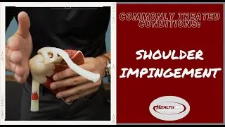 SHOULDER IMPINGEMENT EXPLAINED! - Boca Raton Chiropractor Dr. Gouveia discusses common conditions!