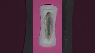 Why Is My Discharge Grey? Could It Be Bacterial Vaginosis (BV)?