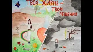Миннесотская модель часть 2