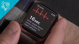 Top 5 Best Smartwatch with ECG