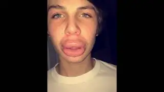 HOW TO GET BIGGER LIPS