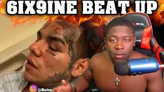 6IX9INE ROBBED AND HOSPITALIZED BEFORE THE FEFE MUSIC VIDEO