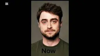 Harry Potter Then VS Now 🥲