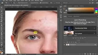 How to remove acne in photoshop