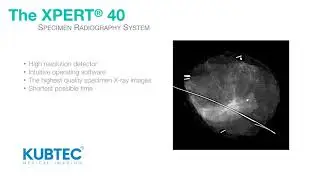 The XPERT 40 System - Digital Imaging for the Operating Room - 01.17.18