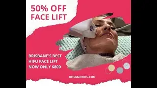 Brisbane's Best HIFU Face Lift!