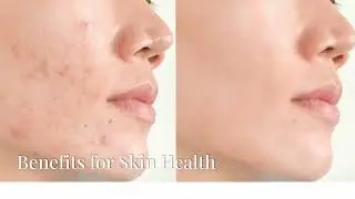Skin Deep: Unveiling The Secrets of Your Skin&rsquo;s Microbiome and Probiotics