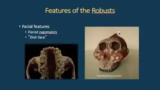 What makes a robust australopith robust?