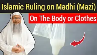 Islamic Ruling on Madhi on the Body or Clothes || Sheikh Assim Al Hakeem 