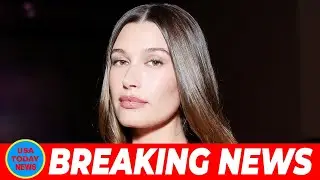 Hailey Bieber Reveals Bruised Eye After Baby Jack Accidentally Slams His Head Into Her Face