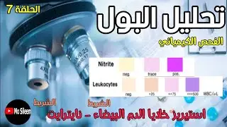 Urinalysis 7 Chemical ex (Leukocyte esterase - Nitrite)