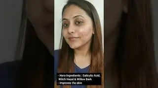 How Does The Derma Co. 2% Salicylic Acid Serum Help