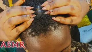 #relax #asmr #asmrsounds #ASMR Deep Hair Scalping, Tingles for Better Relaxation and Sleep