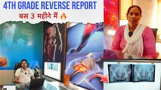 AVN 4th GRADE REVERSE REPORT AVN got cured in just 3 months 🔥 | Sushrut Ayurveda darshan hospital