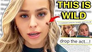 TIK TOK SCAR GIRL GOES VIRAL FOR LYING?! (but is she actually &hellip;)