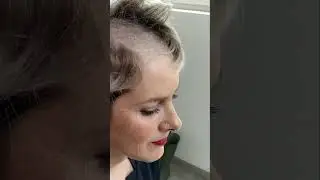 RASAGE &agrave; moiti&eacute;: tendance capillaire?