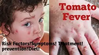 Tomato Fever!Hand Foot Mouth Disease! Risk factors!causes! signs&symptoms!Treatment!precautions!