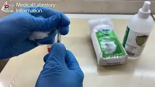 #analysis #medical #bloodteam ھەفتەی یەکەم | خوێن وەرگرتنThe first week | Blood Collection