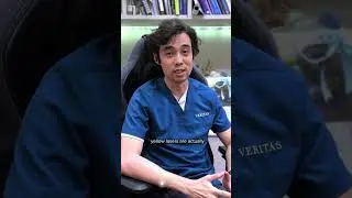 Why Yellow Laser does not work well for dark eye circles
