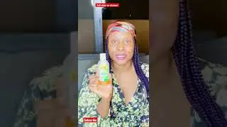 HOW TO USE DETTOL LIQUID ANTISEPTIC TO ClEAR ACNE IN 1 WEEK. #shorts #viral #dettolliquidantiseptic