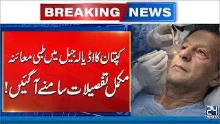 Imran Khan Eye Treatment - Imran Khan Medical Check At Adiala Jail - Complete Details Revealed