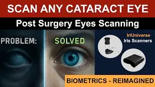 IriUniverse: Iris Capture for Cataract & Post Surgery Eyes with Our Advanced Biometric Iris Scanners