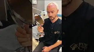 Huub Smit | FUE CT haartransplantatie @ AHI.EU