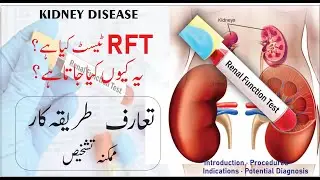 RFT Test | Renal Function Test (RFT) | RFT kiyon kia jata he | Kidney Disease Function Test