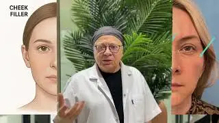 What Is Cheek Filler? Natural Results with the Right Technique