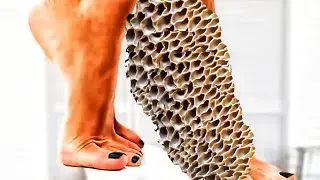 Asmr ! removing white worms , broyozoan, eyes from foot | 2d animation treatment | #animation