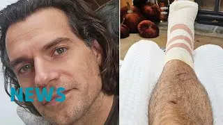Henry Cavill Shares Shirtless Workout Photo as He Heals from &lsquo;Highlander&rsquo; Injury