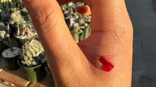 When pets sisters got attacked by husky 