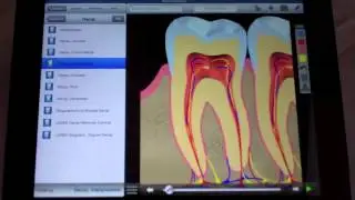 DDS GP Tutorial: The Main Menu