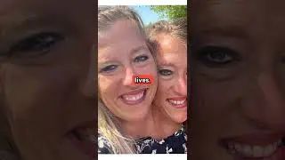 Conjoined Twins Abby and Brittany Hensel Explain Their 