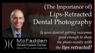 Lips Retracted Photography IMPORTANCE of FINAL