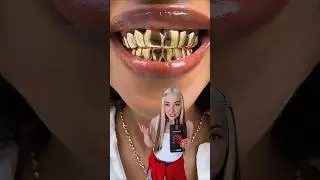 Как относитесь к украшениям для зубов?🔥леденцы с ксилитом арт. ВБ #712387768 Озон #3248433508