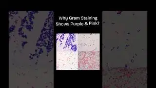 Gram Staining Explained in Seconds 🔬✨|#youtubeshorts #shorts #microbiology #gramstain #biotech #gene
