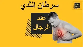 سرطان الثدي عند الرجال