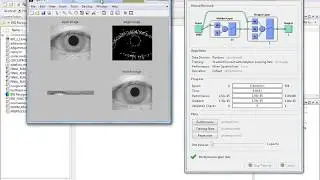 IRIS RECOGNITION USING NEURAL NETWORK LVQ AND CASCADE FORWARD BACK PROPOGATION